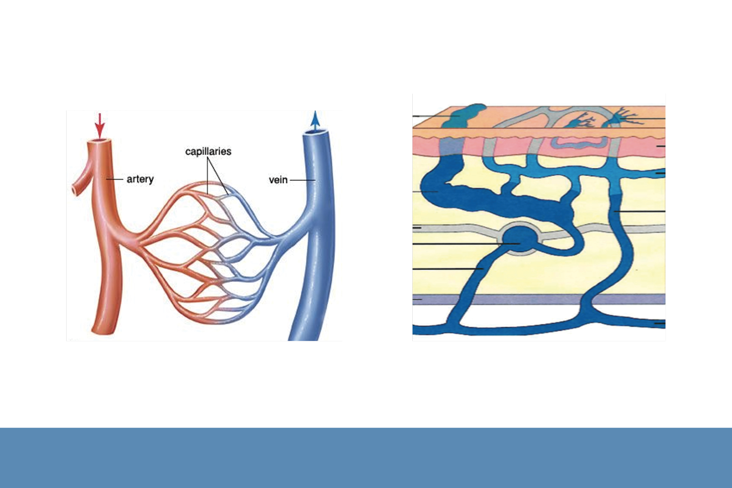 Varicose Veins